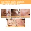 EELHOE Glycolic Acid 7% Toner, Acne Lighten Acne Acne Mark Moisturize Skin Toner
