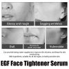 EELHOE Egf Face Tightener Serum, Lighten Fine Lines Deep Hydrating Firming And Moisturizing Facial Essence